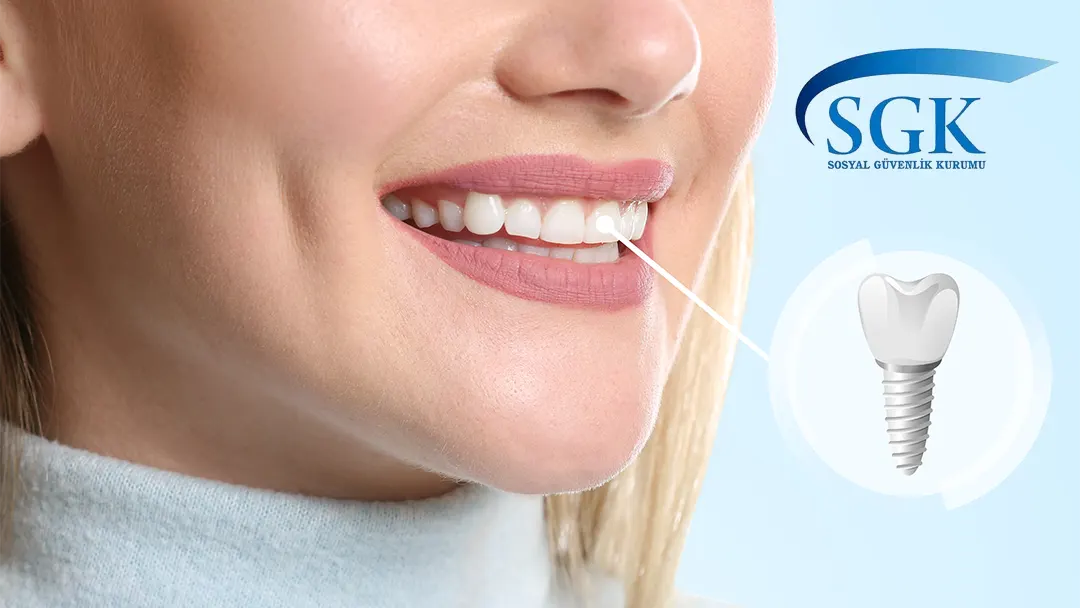 sgk devlette implant fiyatlari